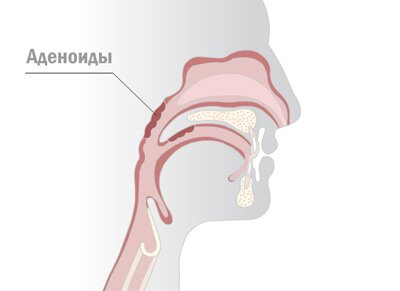 ������� ��������� � ������ � ����� ��� ������ ����������